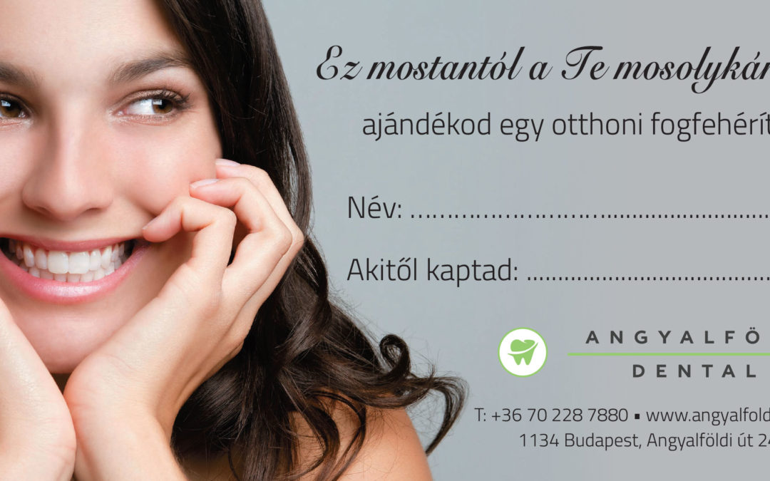 legjobb jelek a bináris opciók áttekintéséhez